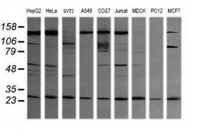 VPS28 Antibody in Western Blot (WB)