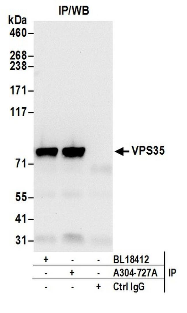 VPS35 Antibody in Western Blot (WB)