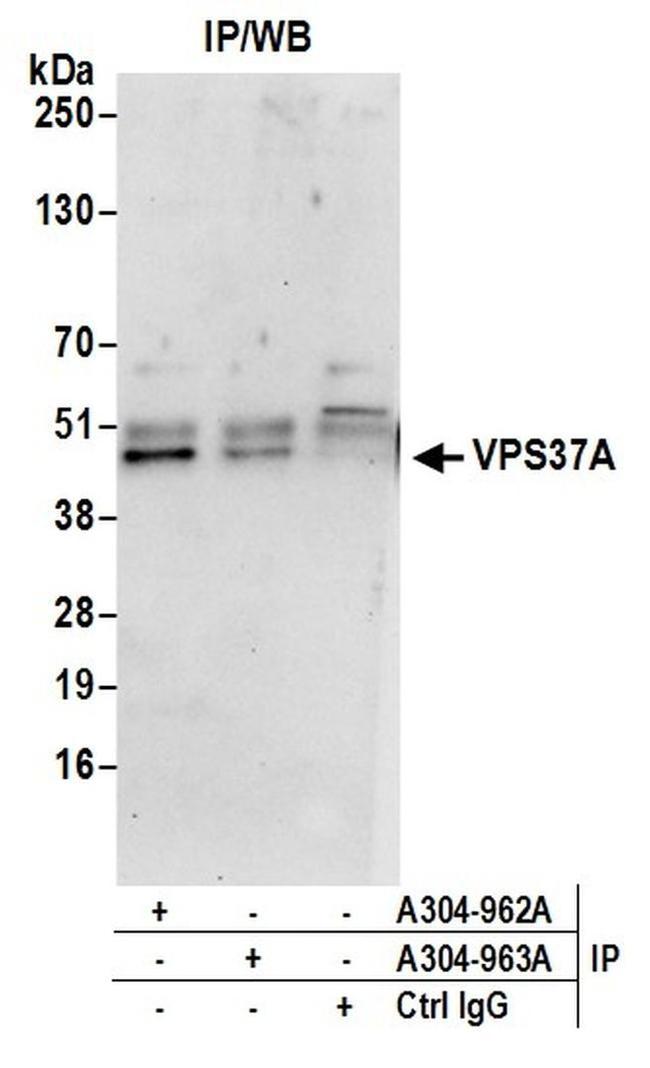 VPS37A Antibody in Western Blot (WB)