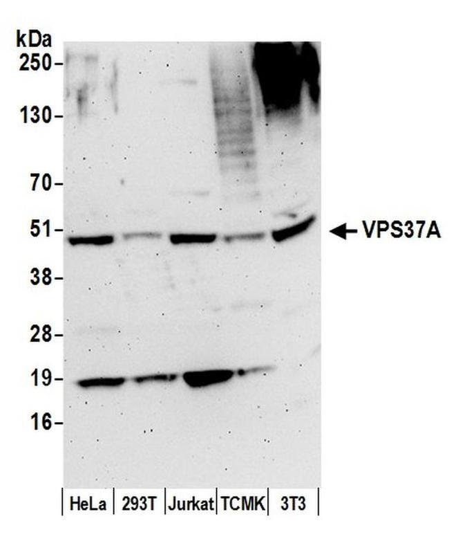 VPS37A Antibody in Western Blot (WB)