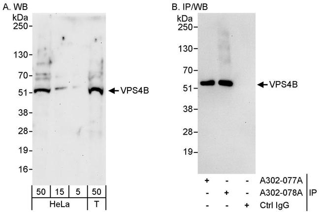 VPS4B Antibody in Western Blot (WB)