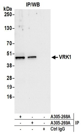 VRK1 Antibody in Immunoprecipitation (IP)