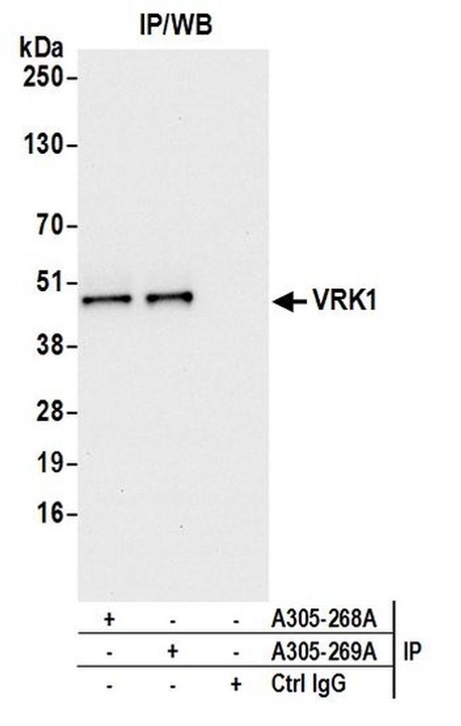 VRK1 Antibody in Western Blot (WB)