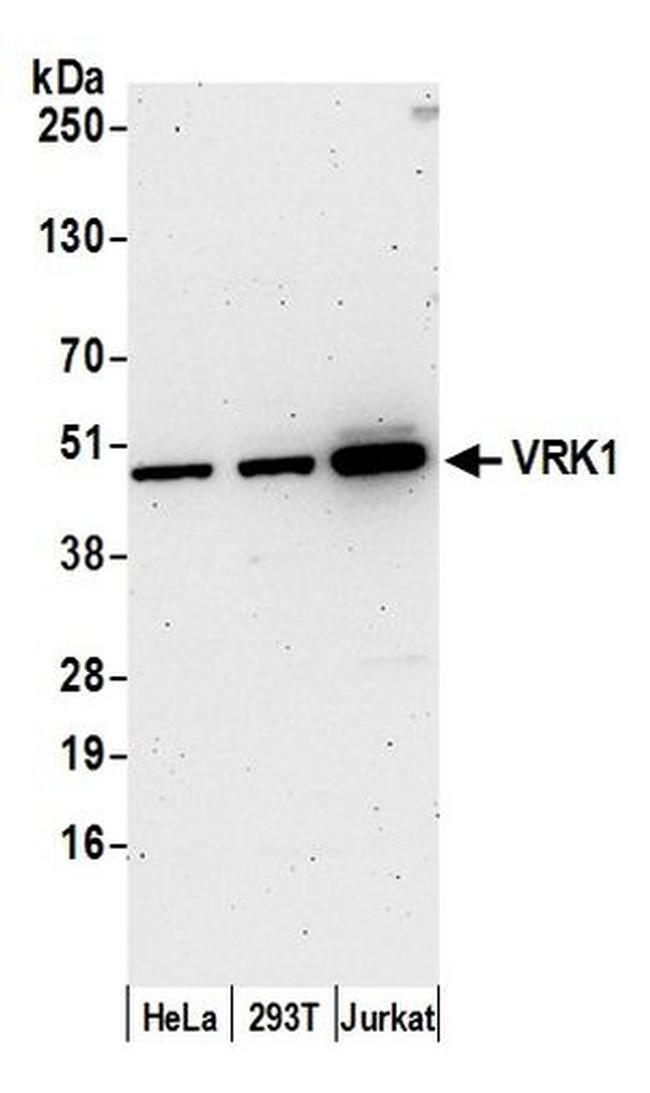 VRK1 Antibody in Western Blot (WB)