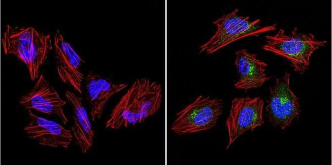 VRK1 Antibody in Immunocytochemistry (ICC/IF)