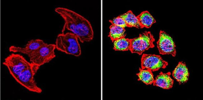 VRK1 Antibody in Immunocytochemistry (ICC/IF)