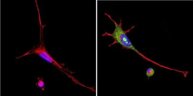 VRK1 Antibody in Immunocytochemistry (ICC/IF)