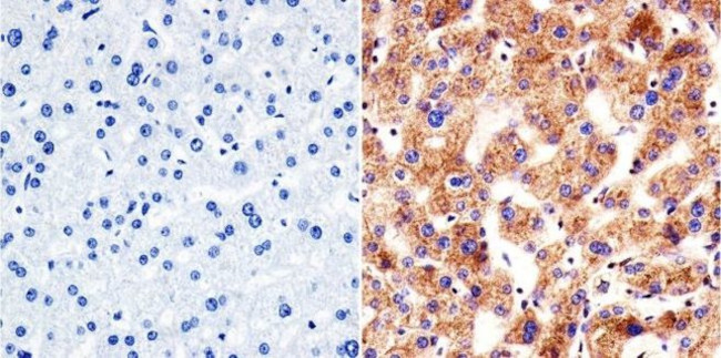 VRK1 Antibody in Immunohistochemistry (Paraffin) (IHC (P))