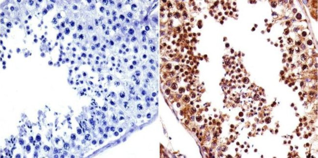 VRK1 Antibody in Immunohistochemistry (Paraffin) (IHC (P))