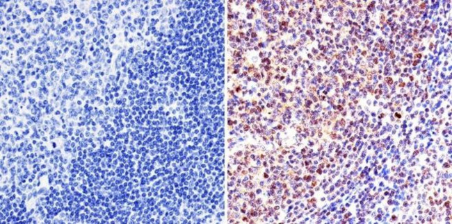 VRK1 Antibody in Immunohistochemistry (Paraffin) (IHC (P))