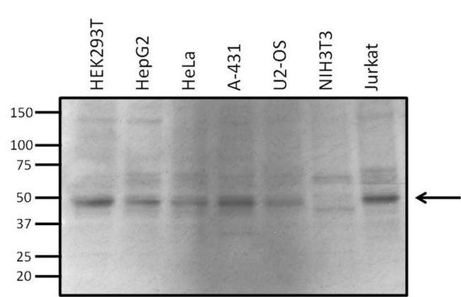 VRK1 Antibody in Western Blot (WB)