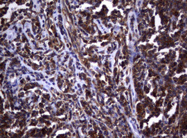 VSNL1 Antibody in Immunohistochemistry (Paraffin) (IHC (P))