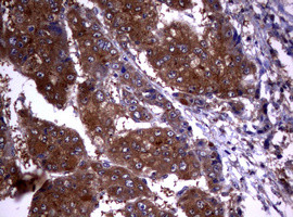 VSNL1 Antibody in Immunohistochemistry (Paraffin) (IHC (P))