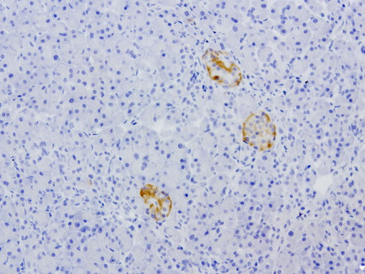 VSNL1 Antibody in Immunohistochemistry (Paraffin) (IHC (P))