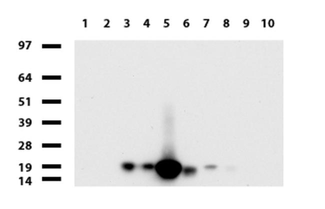 VSNL1 Antibody in Western Blot (WB)