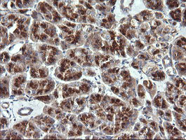 VTI1A Antibody in Immunohistochemistry (Paraffin) (IHC (P))