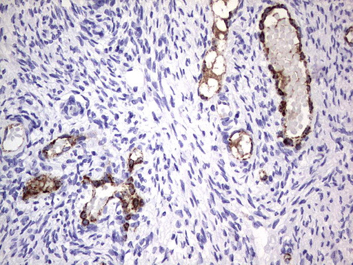 VWF Antibody in Immunohistochemistry (Paraffin) (IHC (P))