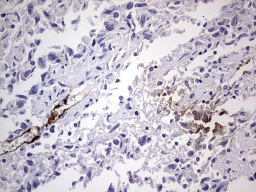 VWF Antibody in Immunohistochemistry (Paraffin) (IHC (P))