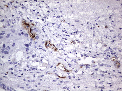 VWF Antibody in Immunohistochemistry (Paraffin) (IHC (P))