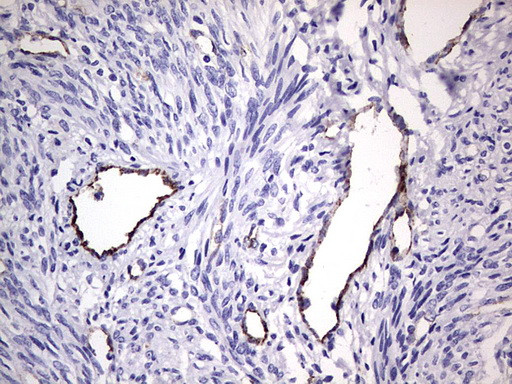 VWF Antibody in Immunohistochemistry (Paraffin) (IHC (P))