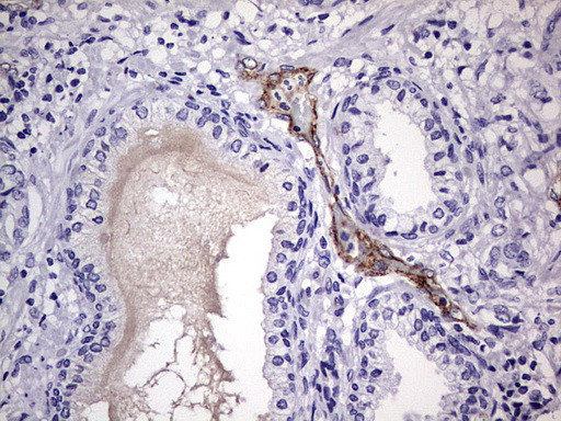 VWF Antibody in Immunohistochemistry (Paraffin) (IHC (P))