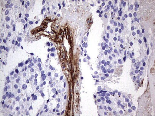 VWF Antibody in Immunohistochemistry (Paraffin) (IHC (P))