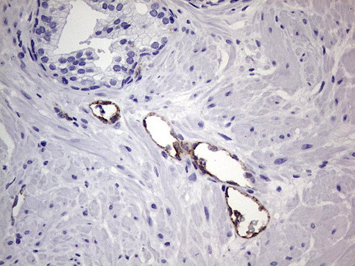 VWF Antibody in Immunohistochemistry (Paraffin) (IHC (P))