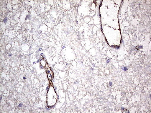 VWF Antibody in Immunohistochemistry (Paraffin) (IHC (P))