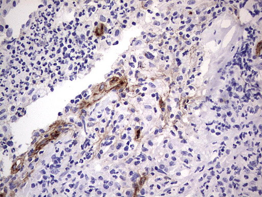 VWF Antibody in Immunohistochemistry (Paraffin) (IHC (P))