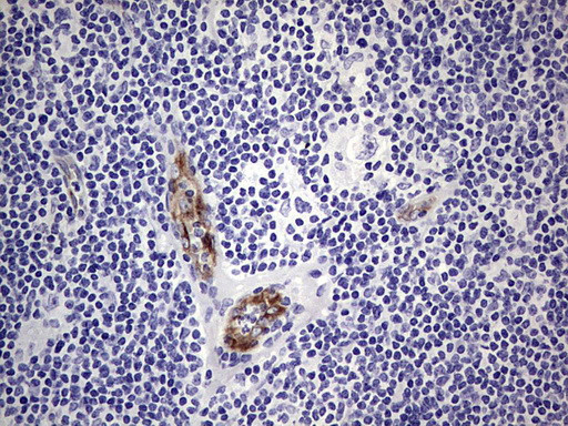 VWF Antibody in Immunohistochemistry (Paraffin) (IHC (P))