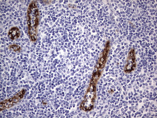 VWF Antibody in Immunohistochemistry (Paraffin) (IHC (P))