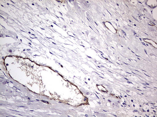 VWF Antibody in Immunohistochemistry (Paraffin) (IHC (P))