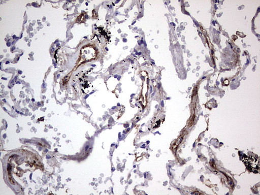 VWF Antibody in Immunohistochemistry (Paraffin) (IHC (P))