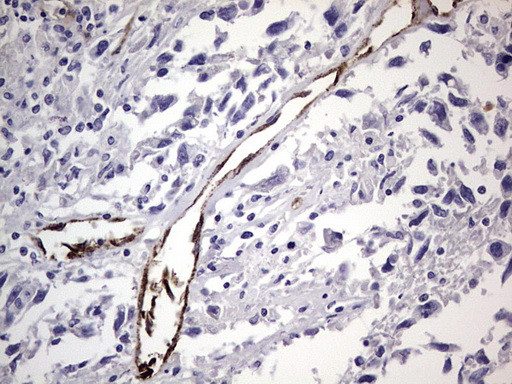 VWF Antibody in Immunohistochemistry (Paraffin) (IHC (P))