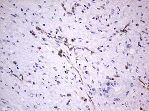 VWF Antibody in Immunohistochemistry (Paraffin) (IHC (P))