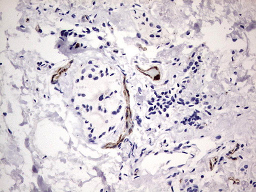 VWF Antibody in Immunohistochemistry (Paraffin) (IHC (P))