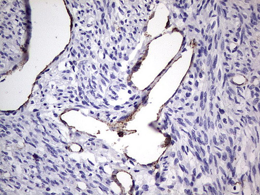 VWF Antibody in Immunohistochemistry (Paraffin) (IHC (P))