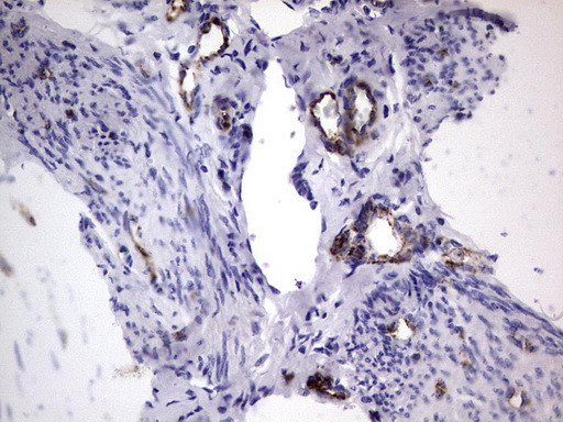 VWF Antibody in Immunohistochemistry (Paraffin) (IHC (P))