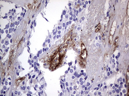 VWF Antibody in Immunohistochemistry (Paraffin) (IHC (P))