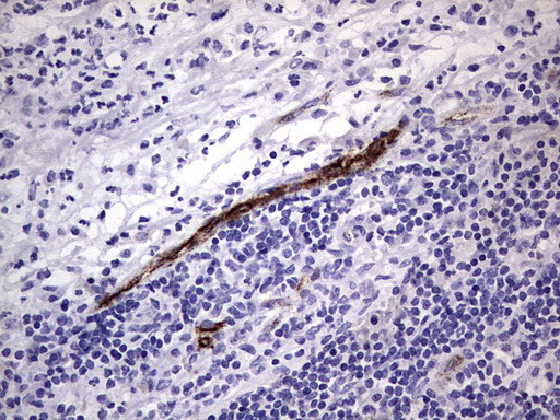 VWF Antibody in Immunohistochemistry (Paraffin) (IHC (P))