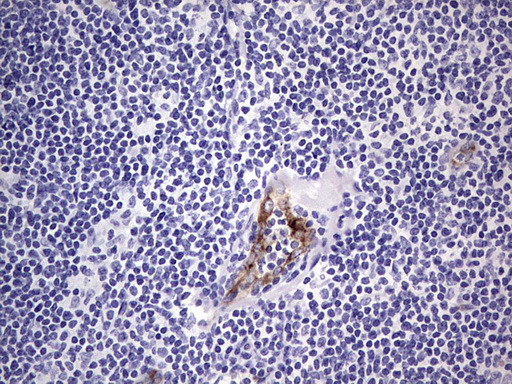 VWF Antibody in Immunohistochemistry (Paraffin) (IHC (P))