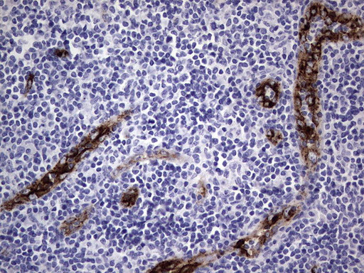 VWF Antibody in Immunohistochemistry (Paraffin) (IHC (P))