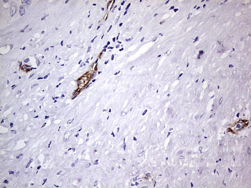 VWF Antibody in Immunohistochemistry (Paraffin) (IHC (P))