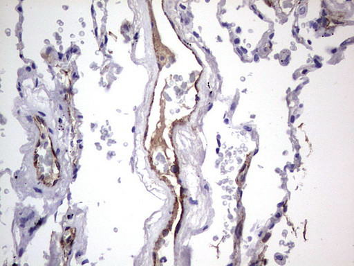 VWF Antibody in Immunohistochemistry (Paraffin) (IHC (P))