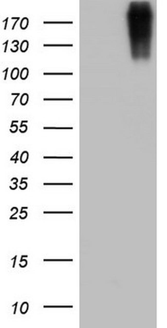 VWF Antibody in Western Blot (WB)