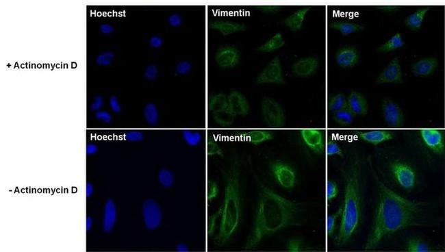 Vimentin Antibody