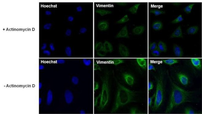 Vimentin Antibody in Immunocytochemistry (ICC/IF)