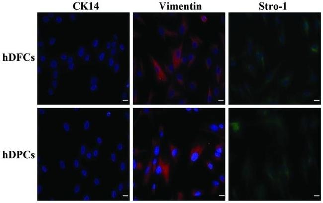 Vimentin Antibody in Immunocytochemistry (ICC/IF)