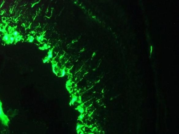 Vimentin Antibody in Immunohistochemistry (Frozen) (IHC (F))