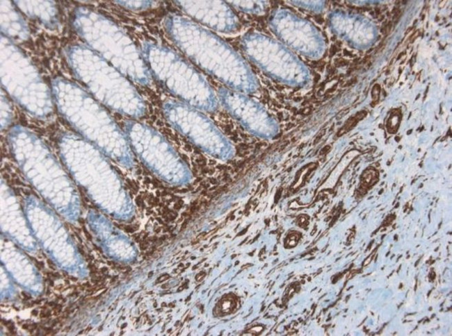 Vimentin Antibody in Immunohistochemistry (Paraffin) (IHC (P))